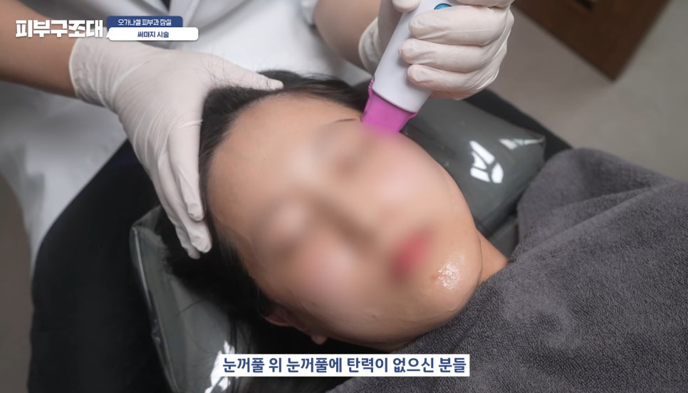 잠실써마지 600샷 실제 관리 후기 장면 다시보기 관련 이미지 17