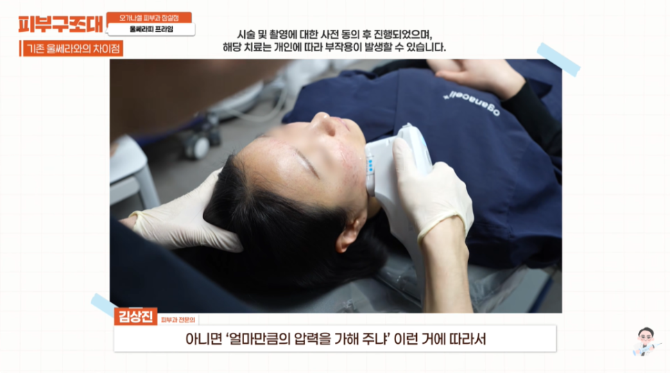 A Must-Read If You’re Concerned About Ultherapy Prime Side Effects in Jamsil image 3
