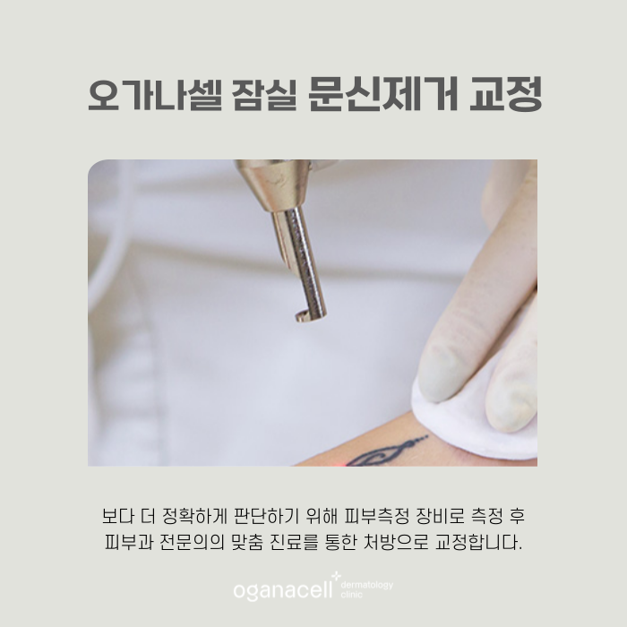 잠실역1번출구 문신제거 잘하는 곳 관련 이미지 6