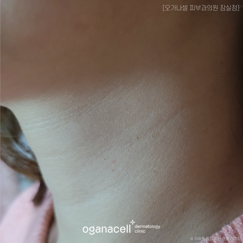 가로 세로 목주름 생기는 원인 등 알아볼게요 관련 이미지 6