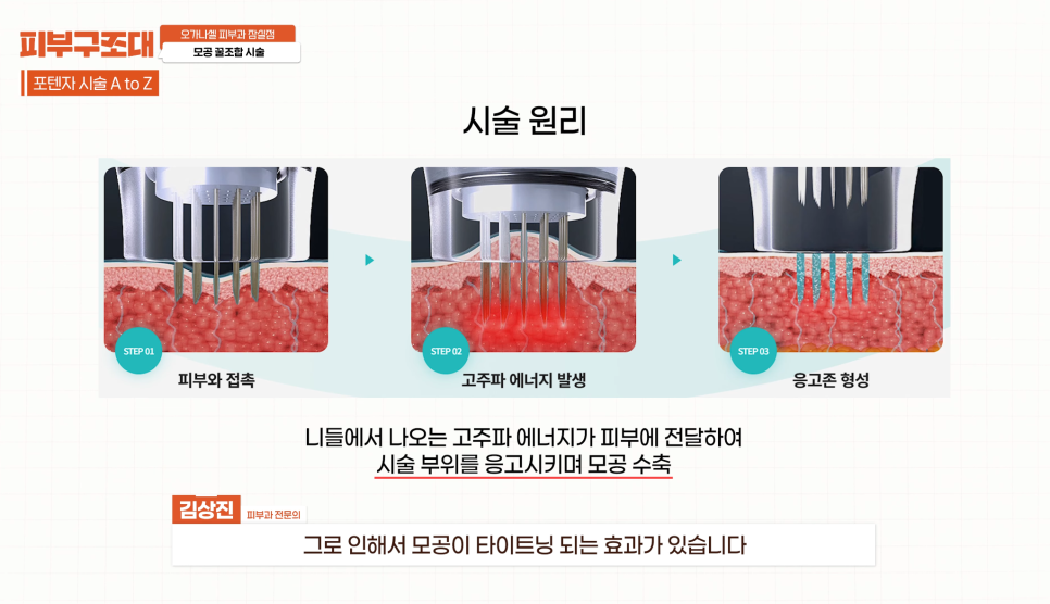 모공 포텐자, 함께 받으면 좋은 잠실피부과 관리 1가지 관련 이미지 8