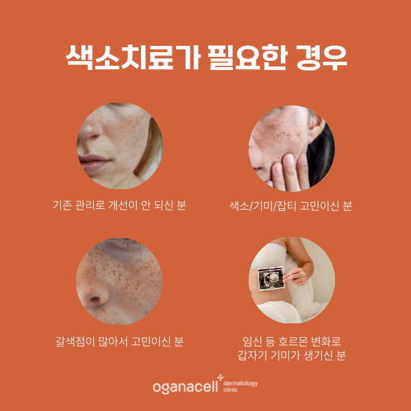 기미 고민 재발방지관리 중요합니다 관련 이미지 3