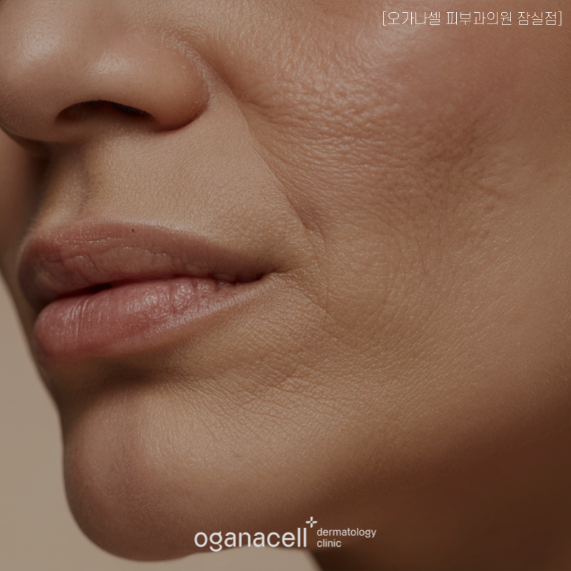 What Treatment Did Oksoon from Season 30 of I Am Solo Receive at a Jamsil AllTight Lifting Dermatology Clinic? image 4