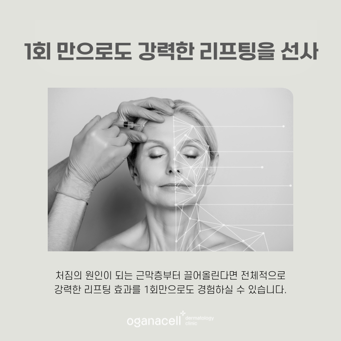 피부 초음파 목관리도 할 수 있는 잠실울쎄라 관련 이미지 4