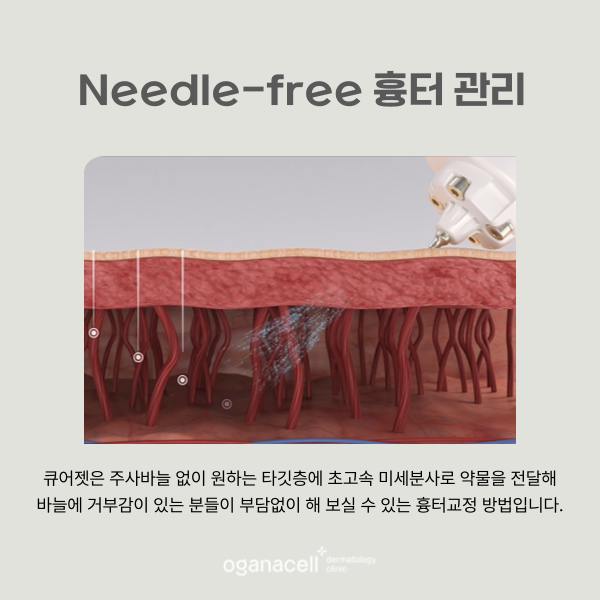 롯데월드타워피부과 흉터 관리 잘하는 곳 관련 이미지 5