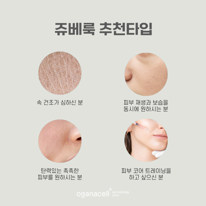 어려지는방법 쥬베룩 효과 관련 이미지 3