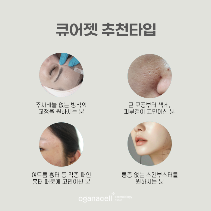 잠실 큐어젯 스킨부스터 잘하는 곳 관련 이미지 3