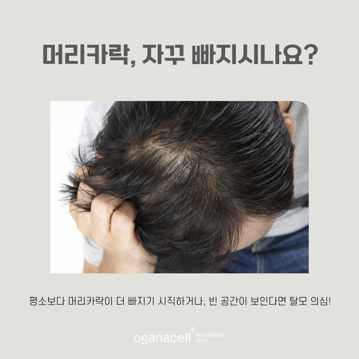 M자부터 정수리까지 자신감을 채워주는 잠실피부과 관련 이미지 6