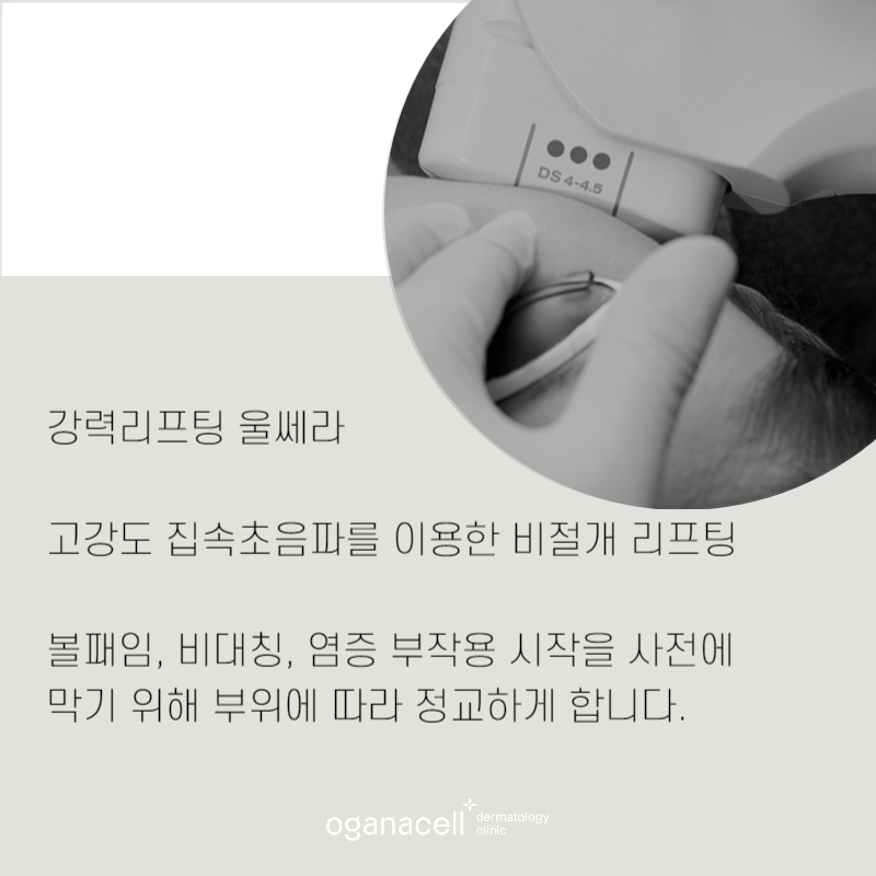강력리프팅 1회만으로도 달라지는 팁 관련 이미지 10