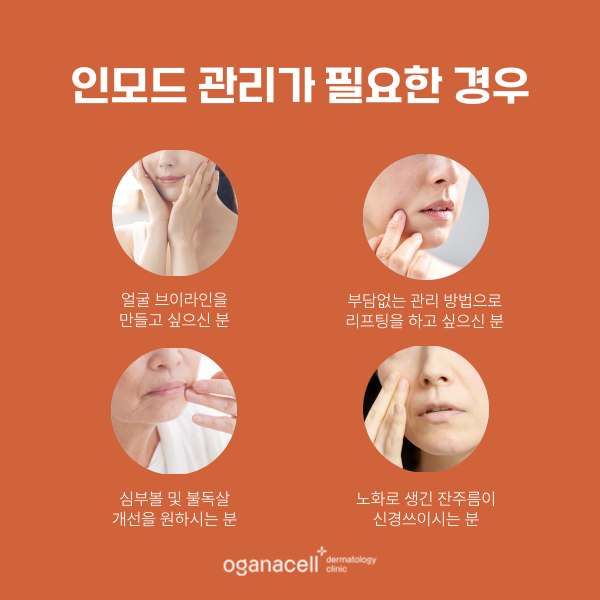 잠실 인모드 유지기간 및 좋은점 관련 이미지 3