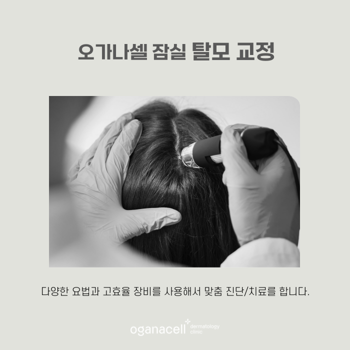M자부터 정수리까지 자신감을 채워주는 잠실피부과 관련 이미지 8