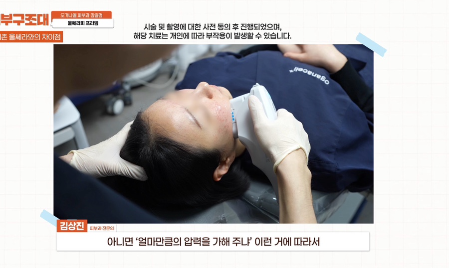 잠실 울쎄라피 프라임 피부과 효과 보는 방법 관련 이미지 4