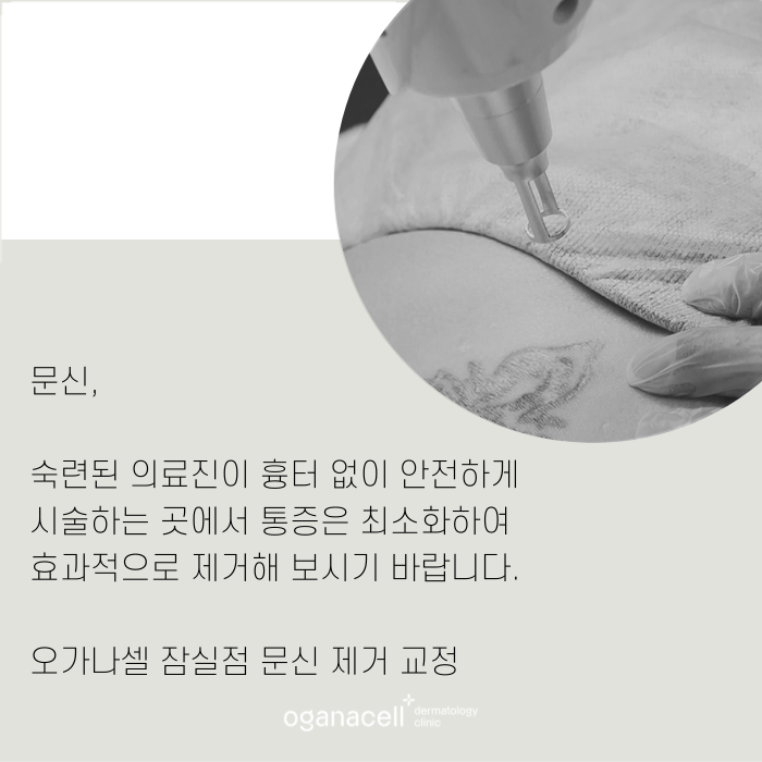 안전하게 문신제거하는 법 관련 이미지 9