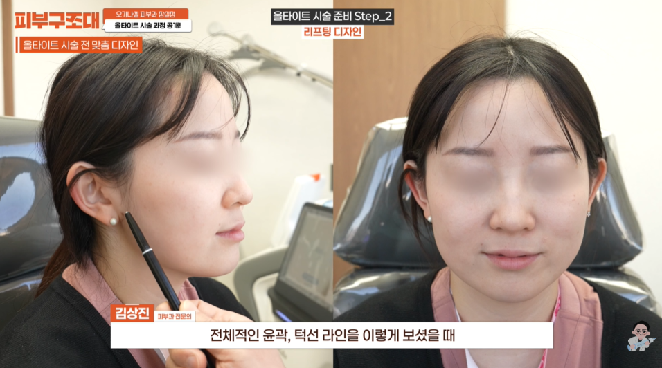 리프팅 입문 가성비 올타이트 후기 공개 관련 이미지 3