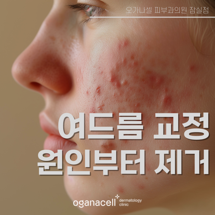 얼굴 트러블 원인 제거해서 해결해 주는 잠실피부과 관련 이미지 1