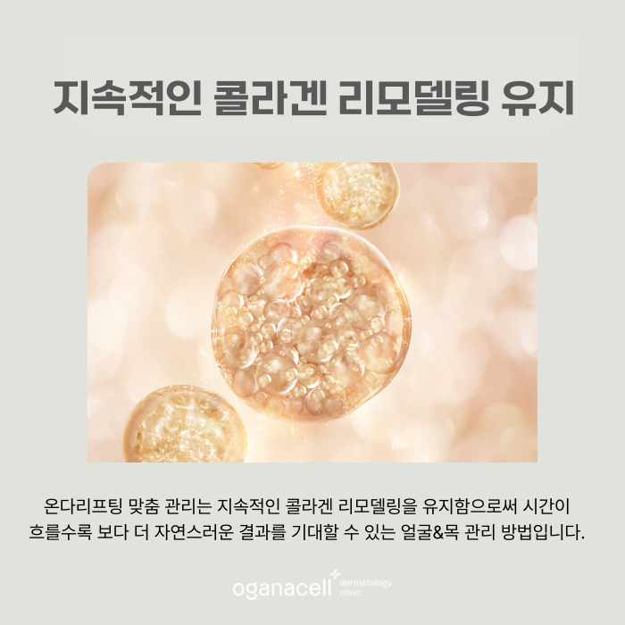 잠실 온다리프팅 얼굴 목 관리 달라야 하는 이유 관련 이미지 6