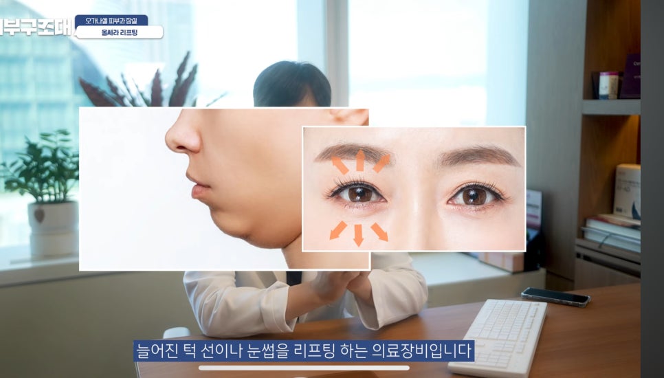 잠실울쎄라 부작용 볼패임을 피하려면? 관련 이미지 3