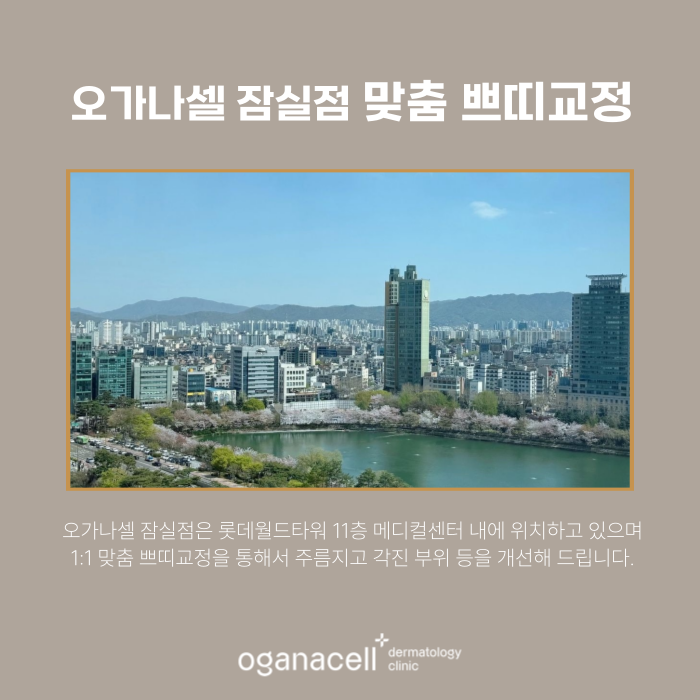 잠실 이마보톡스 전후 비교 후기 관련 이미지 6