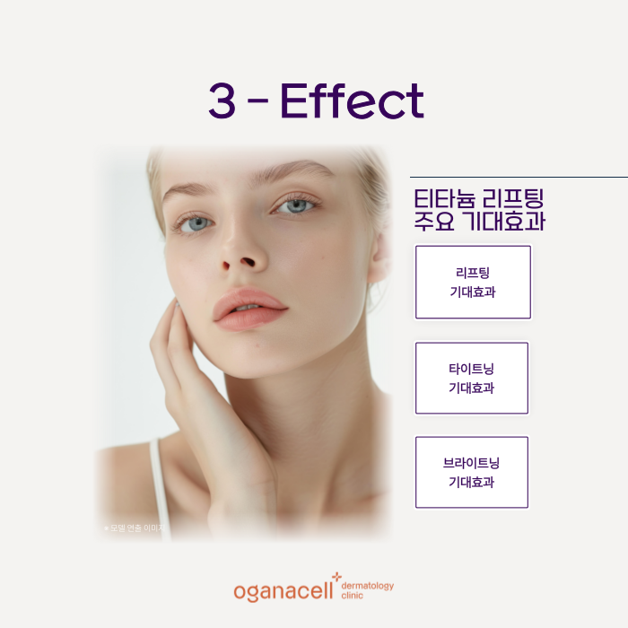 잠실역 티타늄리프팅 원리부터 특징까지 관련 이미지 6
