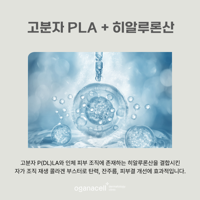 얼굴볼륨 자연스럽게 채우는 방법 쥬베룩볼륨 관련 이미지 6