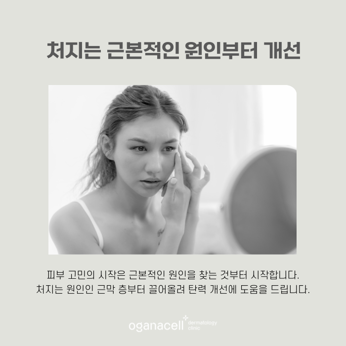 잠실 울쎄라 장단점 알아야 하는 이유 관련 이미지 6
