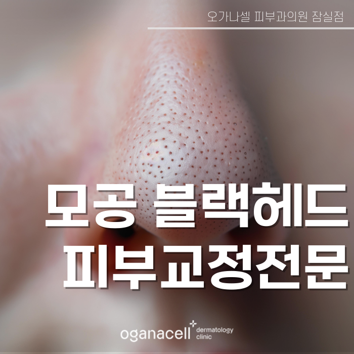 코의피지 제거하는 방법 원인부터 개선해야 관련 이미지 1