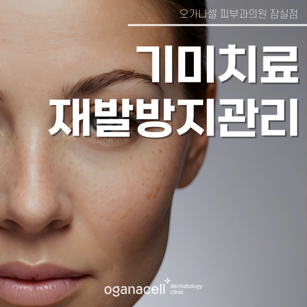 기미 고민 재발방지관리 중요합니다 관련 이미지 1