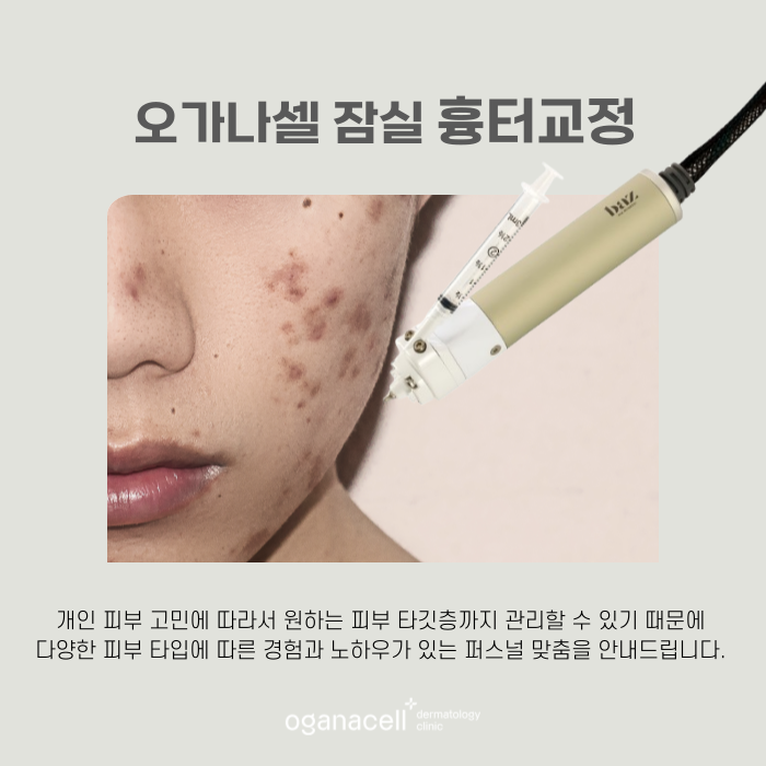 잠실새내 흉터치료 큐어젯 하는 곳 관련 이미지 7