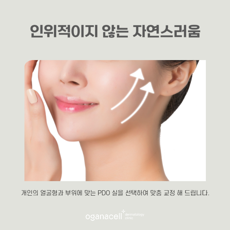 녹는실 종류와 방법에 따라 달라지는 얼굴 관련 이미지 7