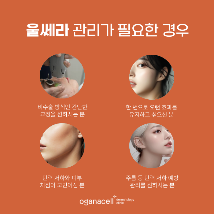 잠실 울쎄라 400샷 600샷 고민될 때 관련 이미지 3
