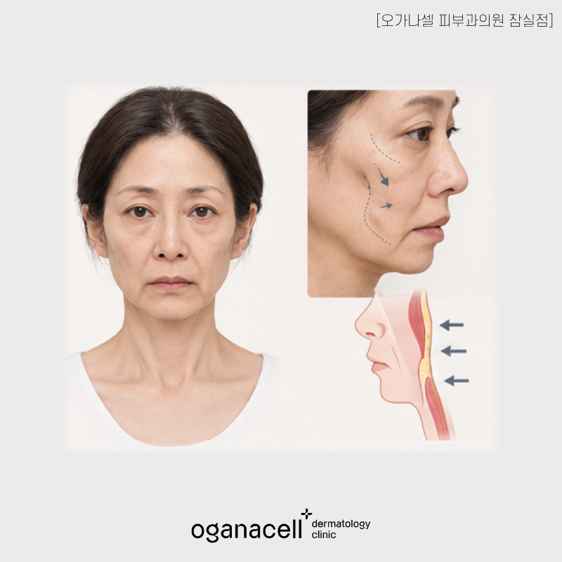 잠실 송파 올타이트, 모두에게 답은 아닙니다 관련 이미지 4