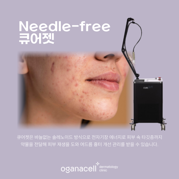 잠실여드름피부과 바늘없는 큐어젯 흉터 관리 방법 관련 이미지 4