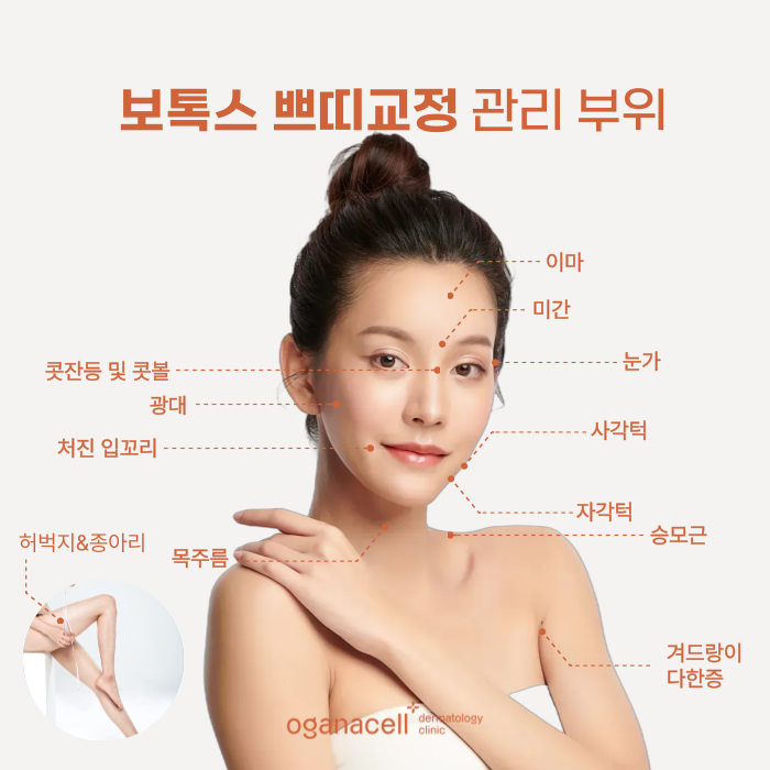 신천동피부과 미간 보톡스 효과 오래 유지하는 법 관련 이미지 5
