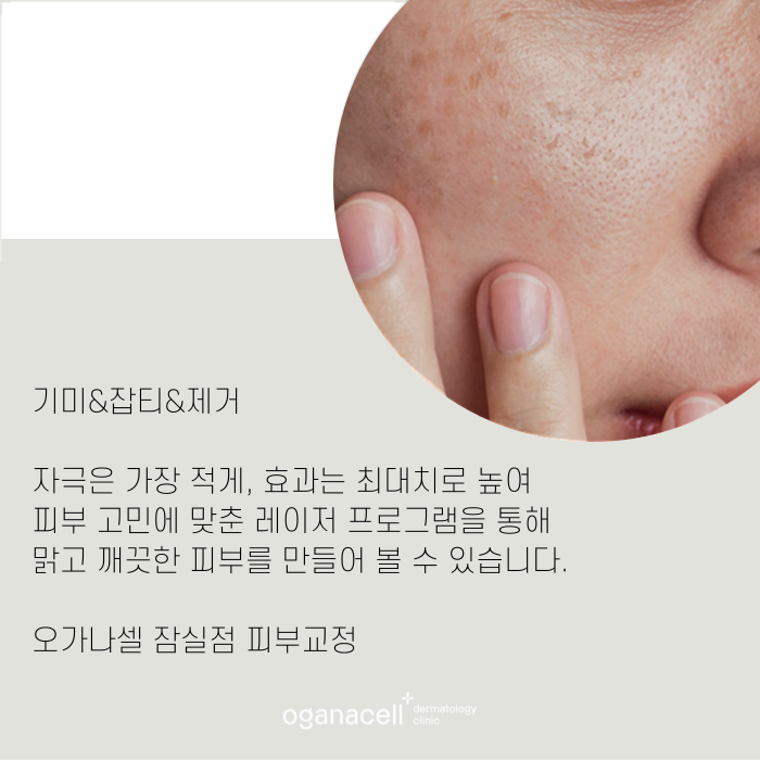 잠실역 피부과 임신출산 후 기미관리 관련 이미지 9