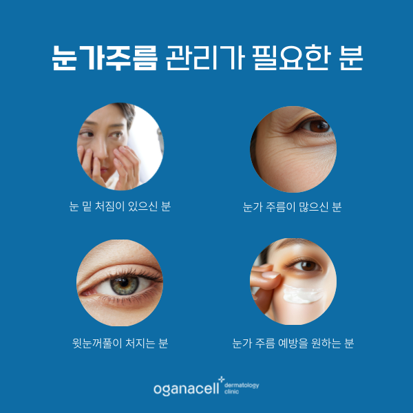 눈가주름없애는법 4가지 - 아이울쎄라 아이리쥬란 아이써마지 눈가보톡스 관련 이미지 3