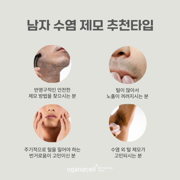 남자수염제모 깨끗하게 잘하는 잠실피부과 관련 이미지 3