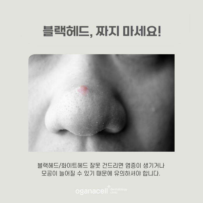 잠실 모공 피부과 잘하는 곳 관련 이미지 4
