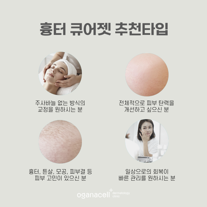 흉터 큐어젯 잠실역피부과 관련 이미지 3