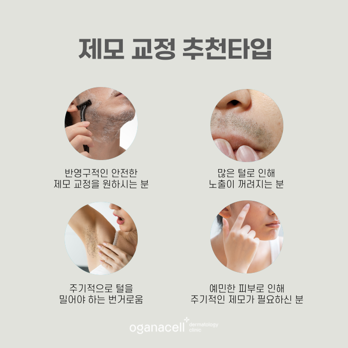 반영구제모 안전하게 할 수 있는 잠실피부과 관련 이미지 3