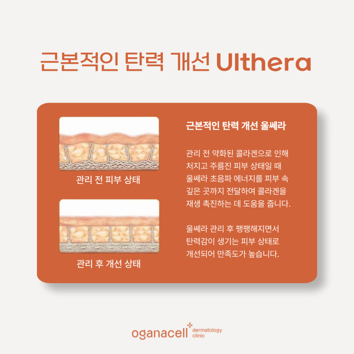 잠실역 울쎄라 1번 출구와 가까운 오가나셀 잠실점 관련 이미지 6