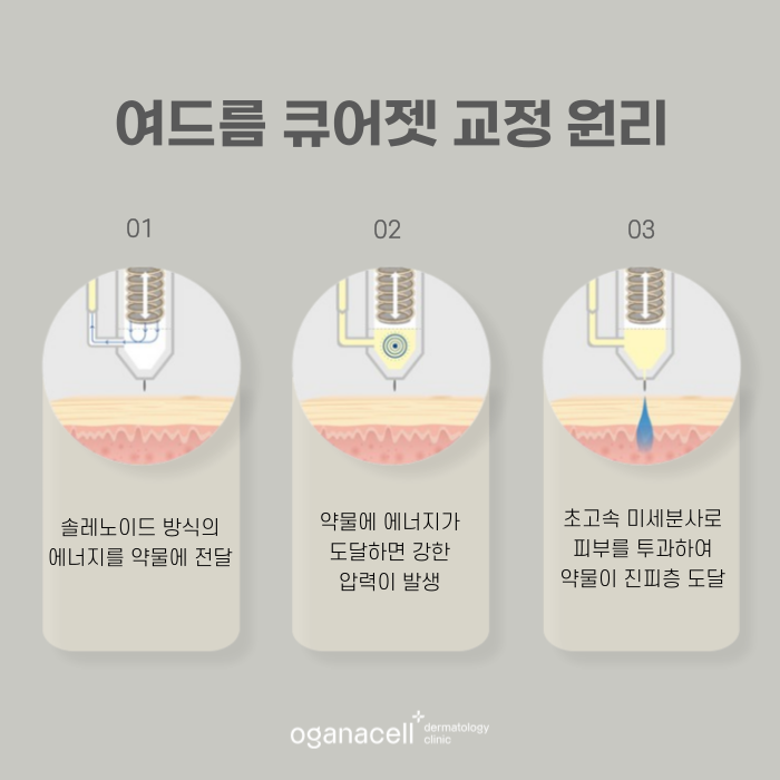 잠실 여드름큐어젯 잘하는 곳 관련 이미지 5