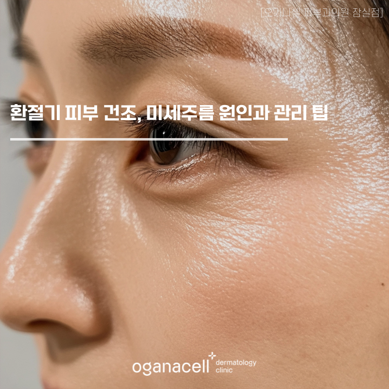 Dry Skin in Seasonal Transitions: Causes of Fine Lines and Care Tips image 1