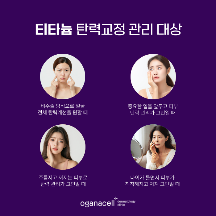 잠실역 티타늄리프팅 원리부터 특징까지 관련 이미지 3