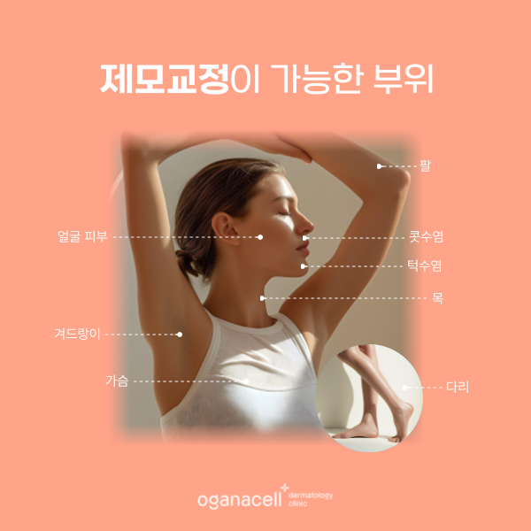 잠실역제모 여름준비 겨드랑이 등 관리법 관련 이미지 6