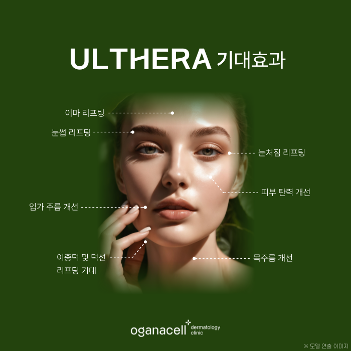 잠실역 피부과 울쎄라 적용부위 등 알아보기 관련 이미지 5