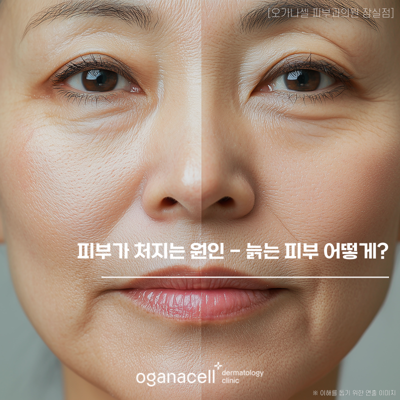 피부가 처지는 원인, 관리해도 늙는 피부 어떻게? 관련 이미지 1