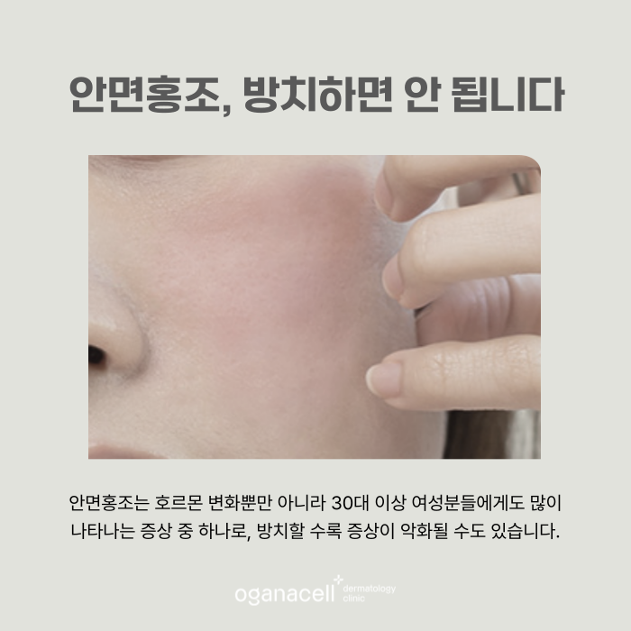 잠실 안면홍조 원인 알고 관리해야 하는 이유 관련 이미지 4