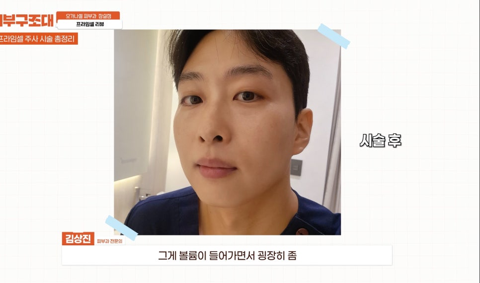연예인피부관리 프라임셀 직접 해 본 후기 관련 이미지 10