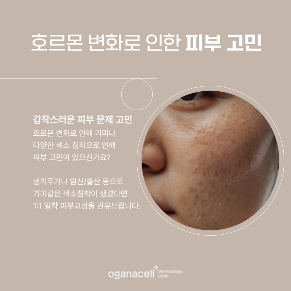 잠실 피부과여의사 피부과 전문의 이현수 원장님 예약안내 관련 이미지 4