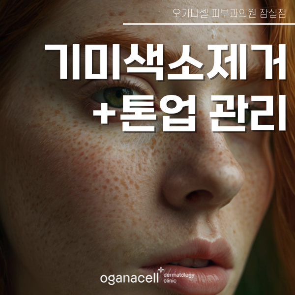 기미 색소 제거 잘하는 잠실 피부과 관련 이미지 1